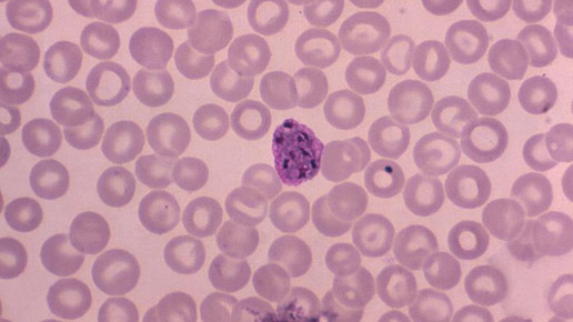 plasmodium malaria cdc dr-mae-melvin