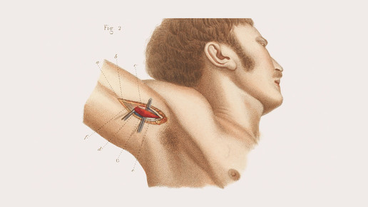 victorian schulter 02 wellcomecollection