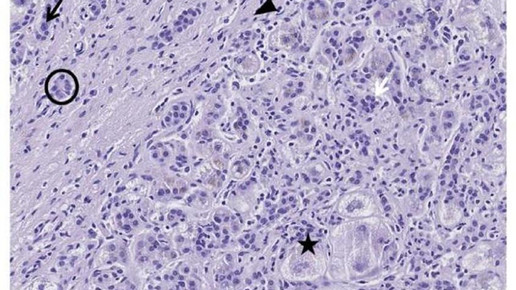 160621 kupferspeicherkrankheit helmholtz zentrum3