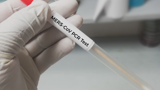 Impfstoff gegen MERS getestet