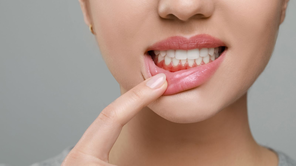 Neue-Zahnpasta-hemmt-Parodontitis-Erreger