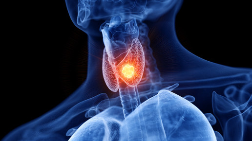 Biotin verfälscht Schilddrüsentests