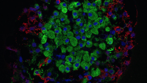 langerhanszellen wikipedia