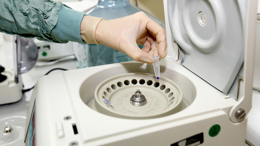 gsk impfstoff zentrifuge analytik gsk