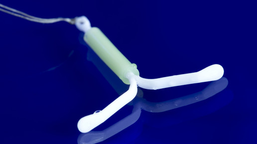 Mirena liegt nun sechs Jahre