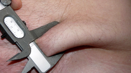 adipositas uebergewicht dieter schuetz pixelio de