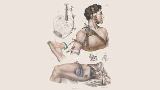 victorian schienen wellcomecollection