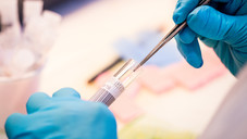 labor charite6 andreas domma Der lange Weg zur Krebsdiagnose