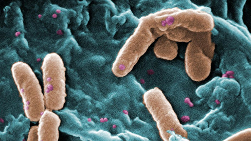 Pseudomonas wikipedia