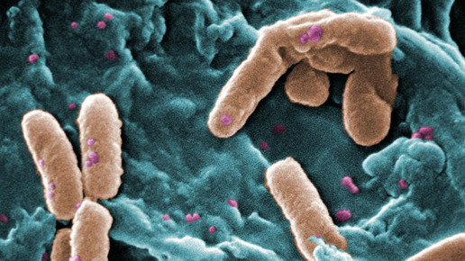 Pseudomonas wikipedia