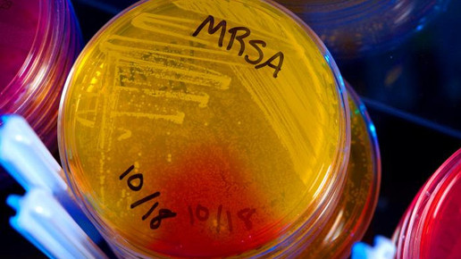 Staphylococcus aureus MRSA cdc james gathany