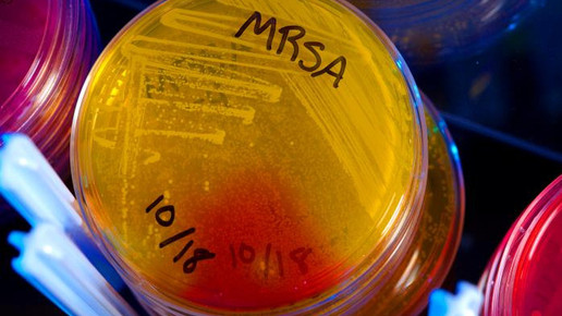 Staphylococcus aureus MRSA cdc james gathany