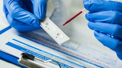 Corona-Antikörper: Keine dauerhafte Immunität möglich?