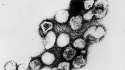 Roetelnvirus CDC Dr Erskine Palmer