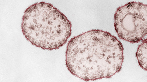 Eltern: Klare Mehrheit für Impfpflicht