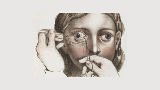 victorian auge wellcomecollection