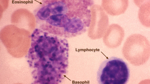 immunzellen CDC Dr Candler Ballard