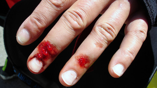 Blut Unfall Dietmar Meinert pixelio.de