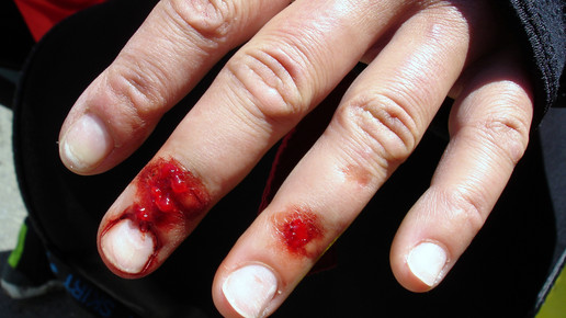 Blut Unfall Dietmar Meinert pixelio.de