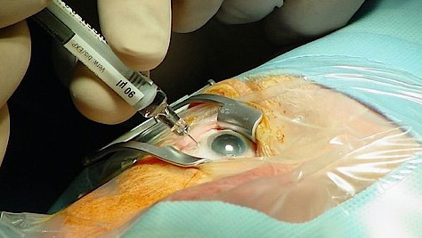 Ximluci: Stada bringt Ranibizumab-Biosimilar