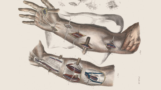 victorian unterarm wellcomecollection