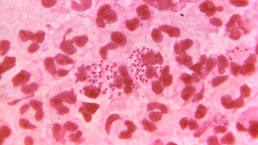 neisseria gonorrhoeae cdc