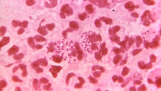 neisseria gonorrhoeae cdc
