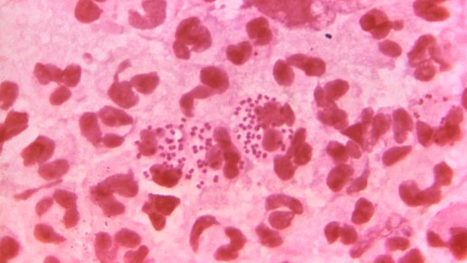 neisseria gonorrhoeae cdc