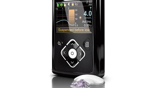 medtronics enlite medtronic