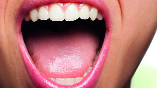 LINDA AG Pressebild Zahngesundheit offener Mund