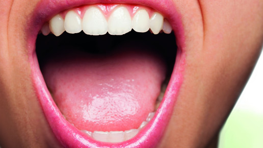 LINDA AG Pressebild Zahngesundheit offener Mund