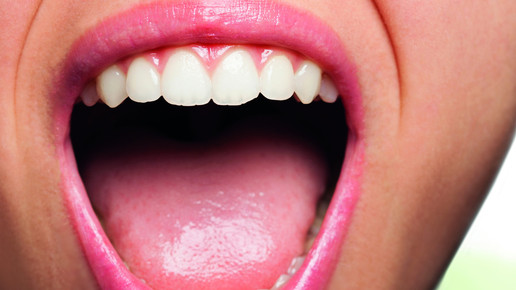 LINDA AG Pressebild Zahngesundheit offener Mund