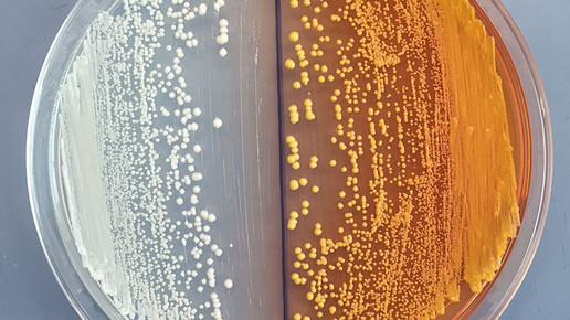 opiate William De Loache UC Berkeley