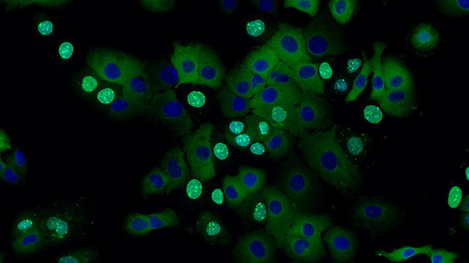 infizioerte zellen marco binder