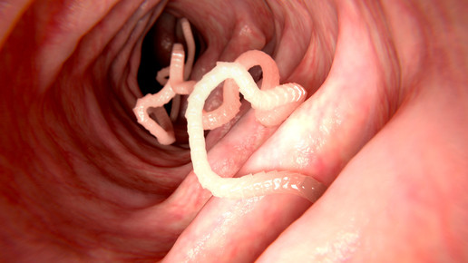 Bandwurmdiät: Mitbewohner zur Gewichtsreduktion