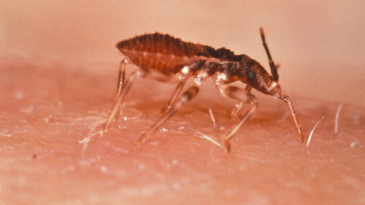 Chagas Disease cdc
